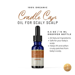 Cradle Cap for Newborns